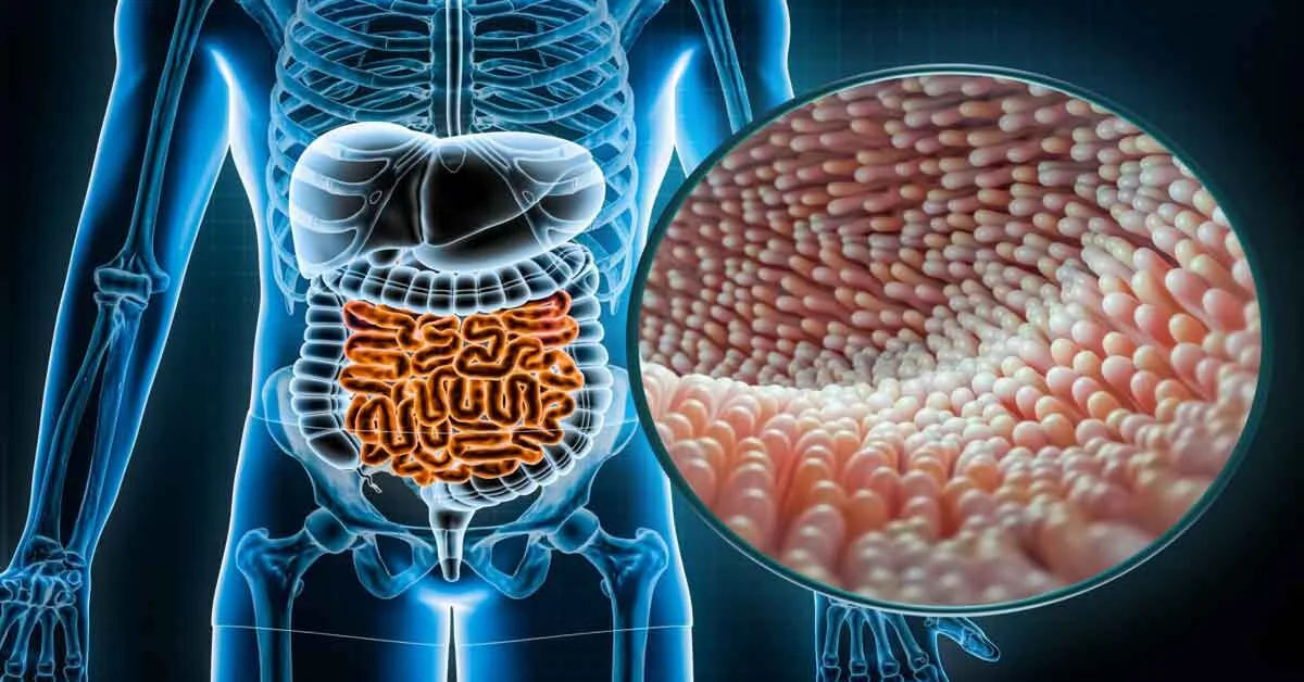 Mikrobioma Usus: Hubungan Antara Bakteri Baik dan Kesehatan Tubuh